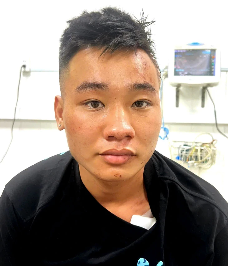 nguyen-duc-anh-17897392018291313623805-1790567966.webp