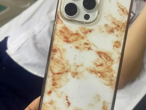 Phẫn nộ người đàn ông đánh nam học sinh đến mặt đầy máu ở Đồng Nai