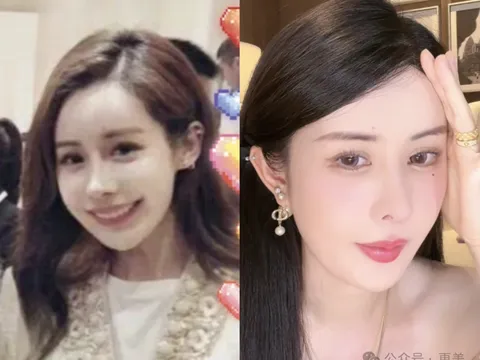 Từ tiệm gội đầu đến giới thượng lưu: Hành trình nhiều tranh cãi của Vi Tuyết